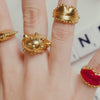Anillo Facelift